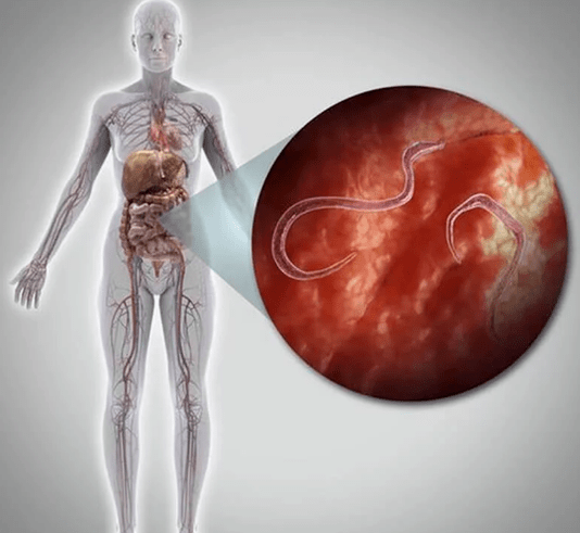 İnsan vücudundaki parazitler