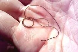 Avucunun içinde parazit