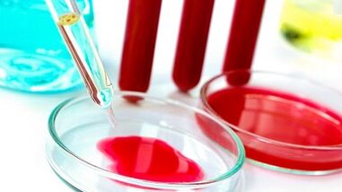 Parazitler için kan testi