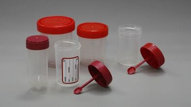 Parazitler testine nasıl hazırlanır