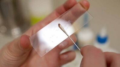 Parazitleri tanımlamak için Calais analizi